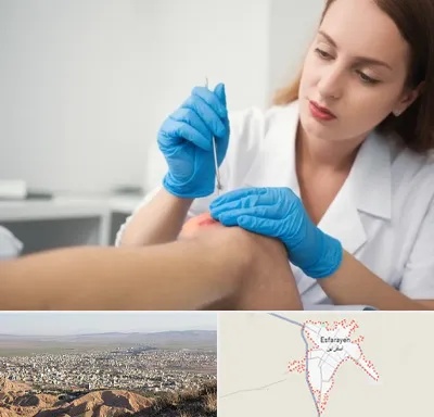 متخصص زخم در اسفراین