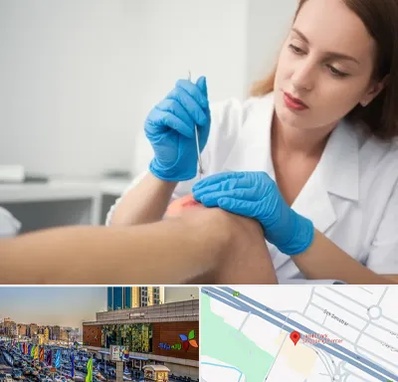 متخصص زخم در لاله پارک تبریز 