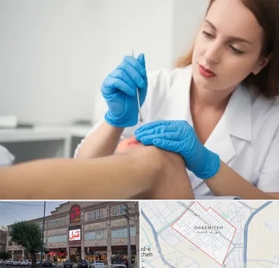 متخصص زخم در قائمیه اسلامشهر 