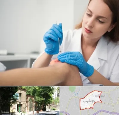 متخصص زخم در دزاشیب