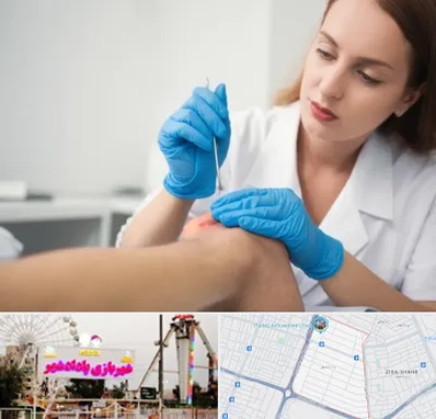 متخصص زخم در پادادشهر اهواز 