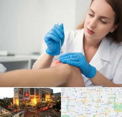 متخصص زخم در جنت آباد تهران 