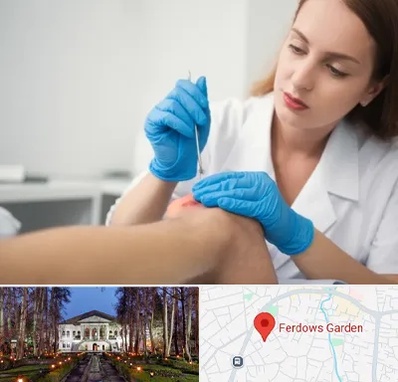 متخصص زخم در باغ فردوس 