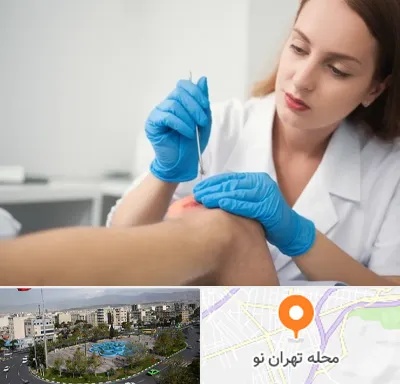 متخصص زخم در تهران نو