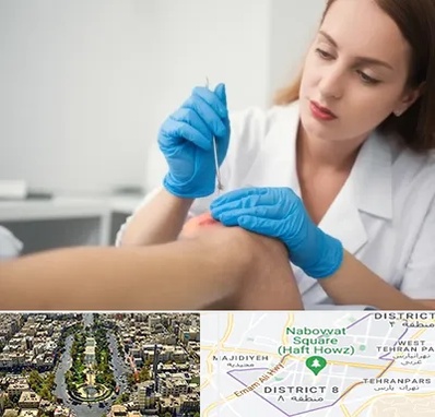متخصص زخم در نارمک