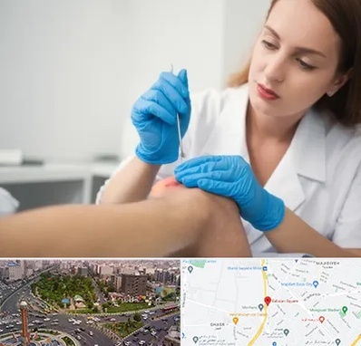 متخصص زخم در سبلان 