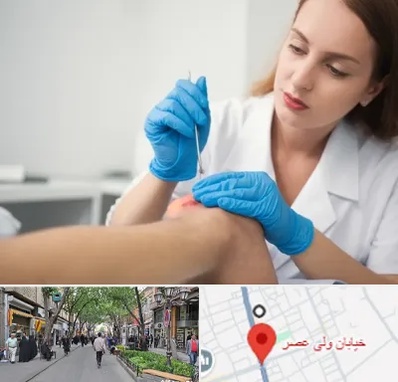 متخصص زخم در ولیعصر شهریار