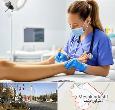 کارشناس زخم در مشکین دشت