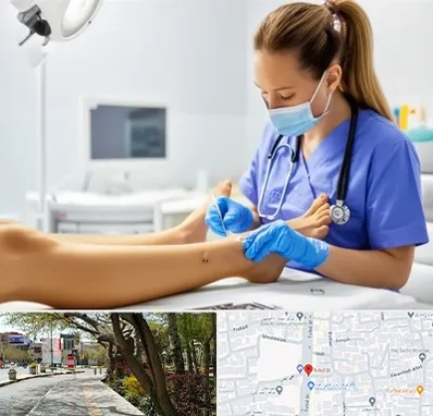 کارشناس زخم در خیابان توحید اصفهان 