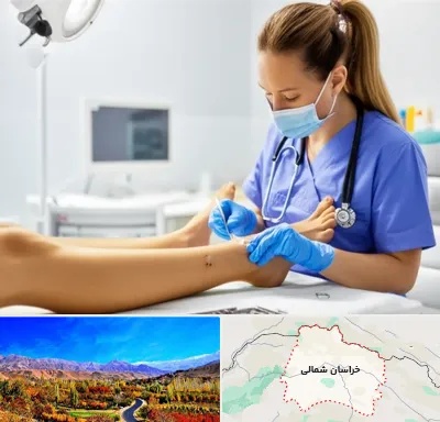 کارشناس زخم در خراسان شمالی