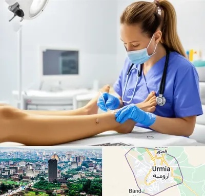 کارشناس زخم در ارومیه