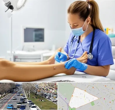 کارشناس زخم در احمدآباد مشهد 