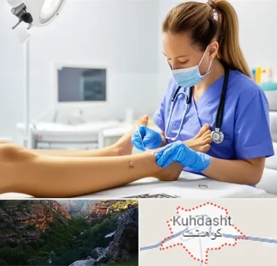 کارشناس زخم در کوهدشت