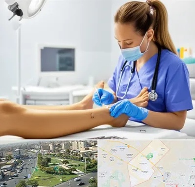 کارشناس زخم در کمال شهر کرج 