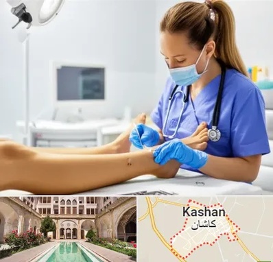 کارشناس زخم در کاشان