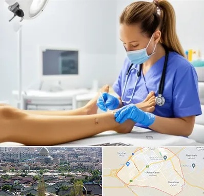 کارشناس زخم در رباط کریم