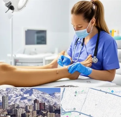 کارشناس زخم در ازگل 