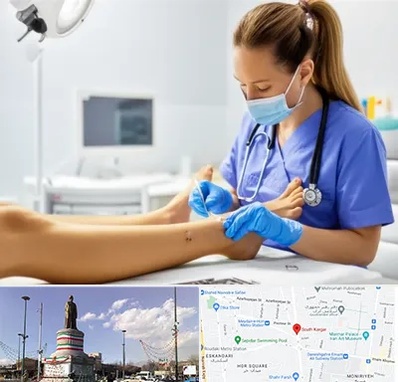 کارشناس زخم در کارگر جنوبی