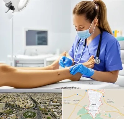 کارشناس زخم در قزوین
