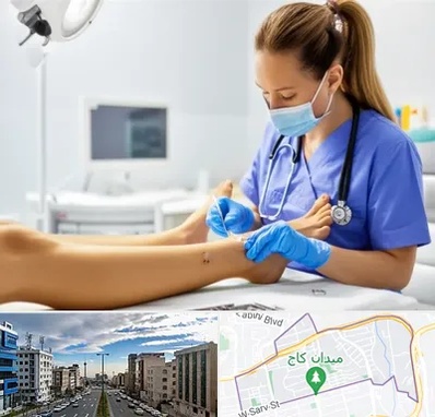 کارشناس زخم در سعادت آباد 