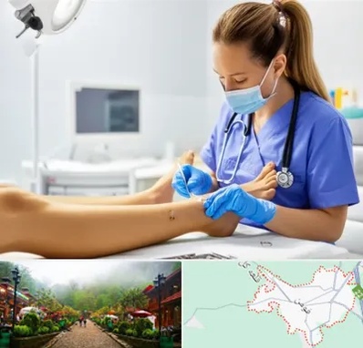 کارشناس زخم در فومن