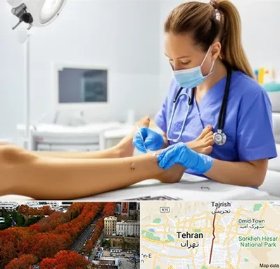 کارشناس زخم در ولیعصر 
