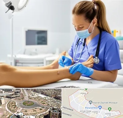 کارشناس زخم در پرند