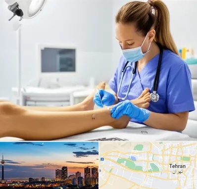 کارشناس زخم در غرب تهران 