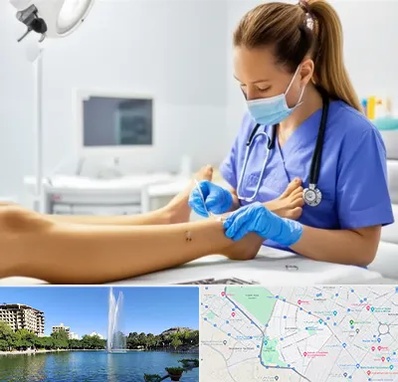 کارشناس زخم در کوهسنگی مشهد 