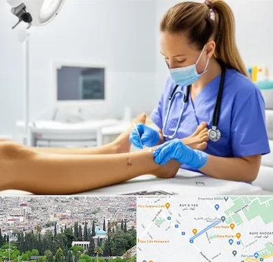 کارشناس زخم در محلاتی شیراز 