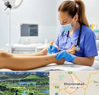 کارشناس زخم در خرم آباد