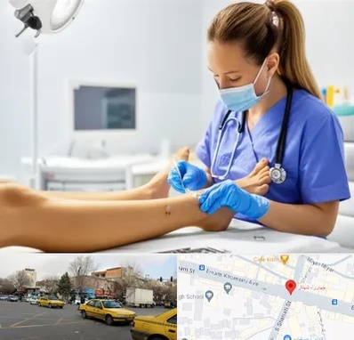 کارشناس زخم در شهناز تبریز 