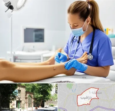 کارشناس زخم در دزاشیب