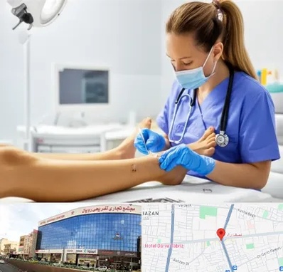 کارشناس زخم در نصف راه تبریز 