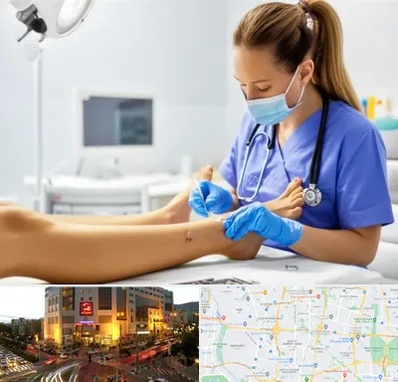 کارشناس زخم در جنت آباد تهران 