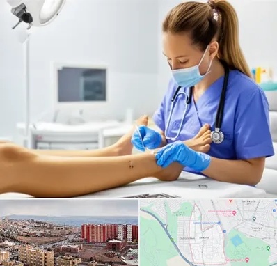 کارشناس زخم در سهند تبریز 