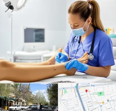 کارشناس زخم در کوی فیروز تبریز 