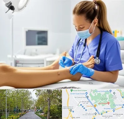 کارشناس زخم در قدوسی غربی شیراز 