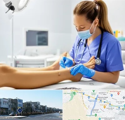 کارشناس زخم در شریعتی مشهد 