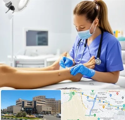 کارشناس زخم در صیاد شیرازی مشهد 