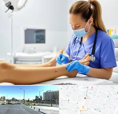 کارشناس زخم در بلوار کلاهدوز مشهد 