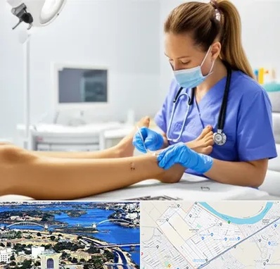 کارشناس زخم در کوروش اهواز 