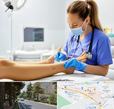 کارشناس زخم در مهرویلا کرج 