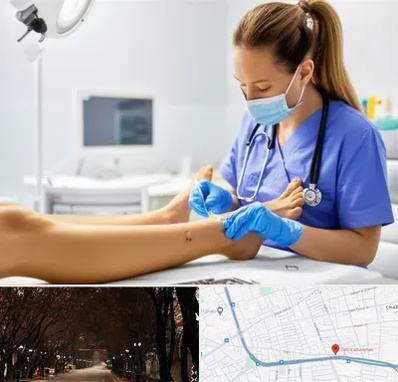 کارشناس زخم در ابوریحان تبریز 