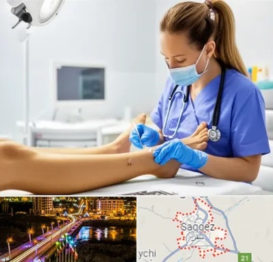 کارشناس زخم در سقز