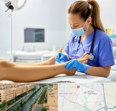 کارشناس زخم در فاز سه اندیشه