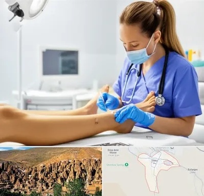 کارشناس زخم در اسکو