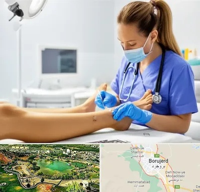 کارشناس زخم در بروجرد