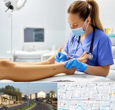 کارشناس زخم در ضیابری رشت 