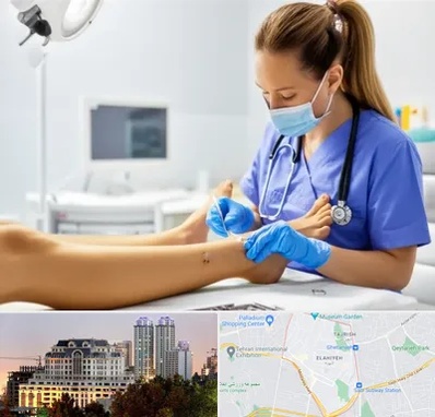 کارشناس زخم در فرشته 